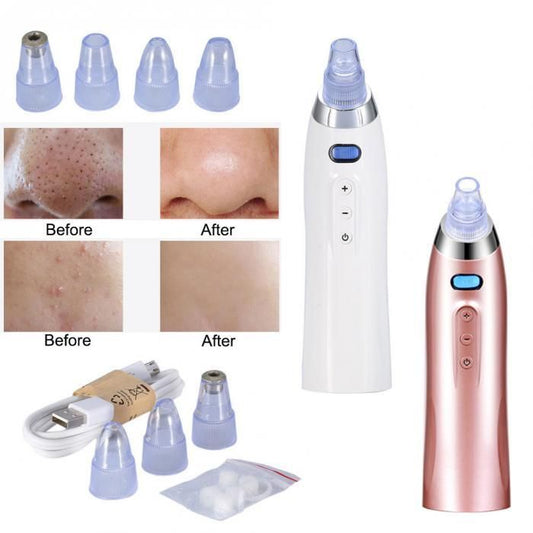 Blackhead Remover